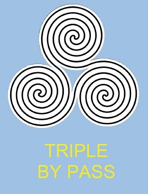 Triple By Pass by Ken Muller